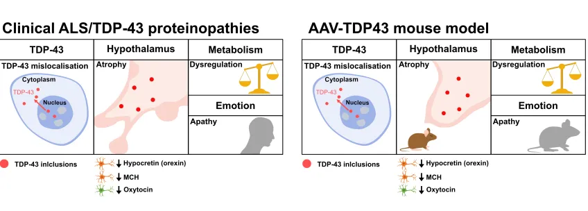 Illustration showing clinical ALS/TDP-43 proteinopathies and AAV-TDP43 mouse model